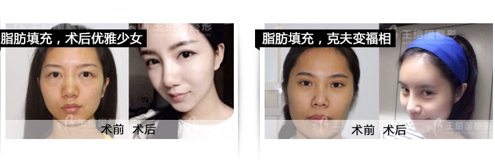 北京爱多邦王绍好不好？整形技术怎么样？|尽美