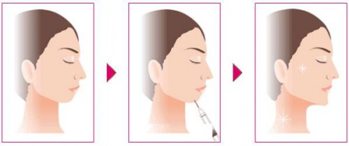 上海天大明慧做吸脂好不好?贵不贵?