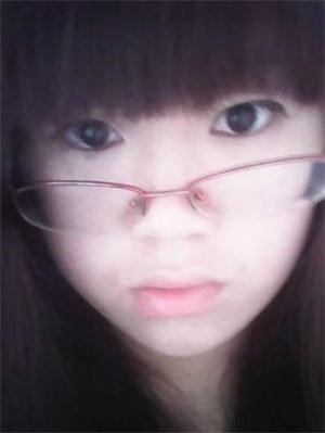 长了太田痣怎么办?如何治疗好?