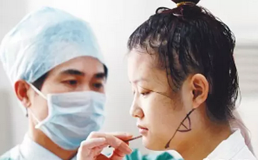 磨颧骨适合哪些人做?哪些脸型可以做?