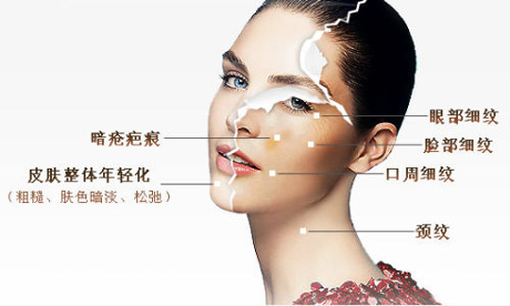什么是光子嫩肤?光子嫩肤怎么做?|尽美网