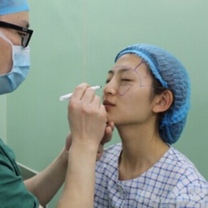 做了面部脂肪移植和垫下巴就像完全变了一个人