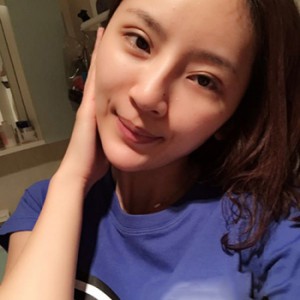 做了面部脂肪移植和垫下巴就像完全变了一个人