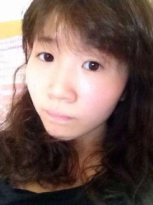 双眼皮+开眼角+隆鼻 来一个大变身