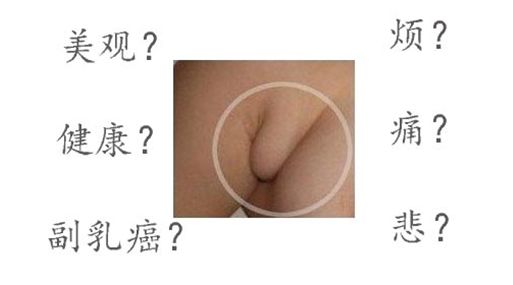 除副乳手术的*佳时机
