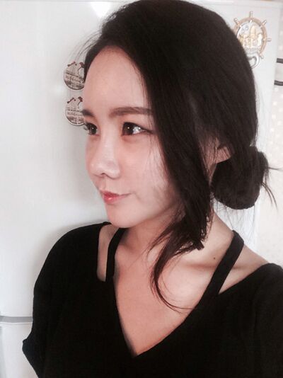 隆鼻+自体脂肪填充，美了