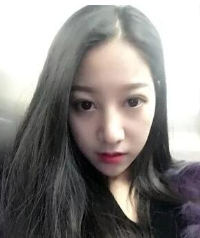 长沙女孩的我隆鼻后的自述,“好险!差一点,