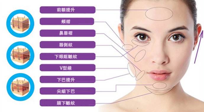 做面部*提升,您需要了解这些