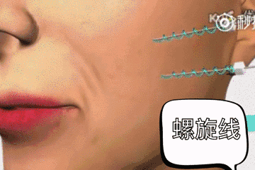 面部*——术前了解!建议收藏