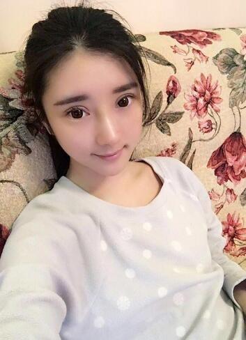 自体脂肪填充和双眼皮修复案例分享
