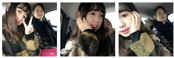 做双眼皮31天了，天气冷不会影响恢复呢