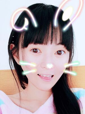 全脸脂肪填充+自体脂肪丰胸，爱美者反馈*果