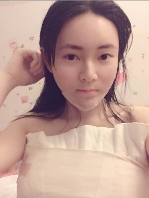 全脸脂肪填充+自体脂肪丰胸，爱美者反馈*果