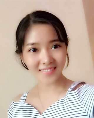 长沙希美蒋松林做双眼皮的案例反馈，价格8400元