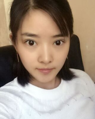 长沙希美蒋松林做双眼皮的案例反馈，价格8400元
