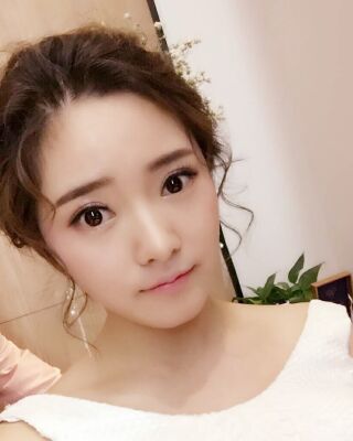 长沙希美蒋松林做双眼皮的案例反馈，价格8400元