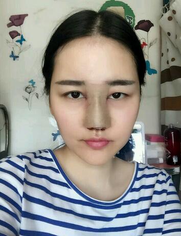 北京八大处范飞*案例分享，价格29000元