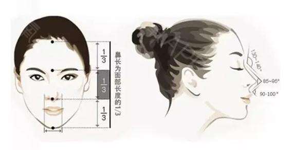 鹰钩鼻、朝天鼻、塌鼻子的隆鼻方式有哪些?—