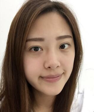 *美容前后*果对比照，很喜欢这个皮肤年