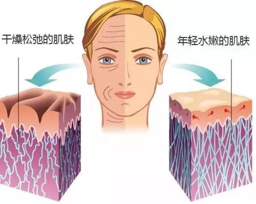 微整必须要注意的事项