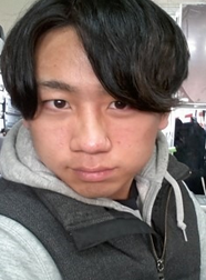 尽美网男士歪鼻矫正反馈案例