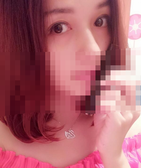 88天的蜕变，单眼皮变双眼皮