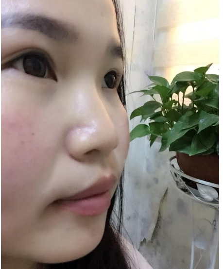 刚做了个*，今天第三天