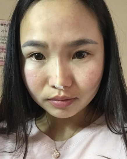 刚做了个*，今天第三天