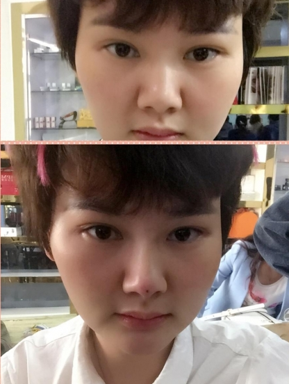 刚做了个*，今天第三天