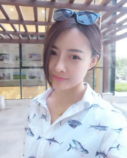 今年37岁了，做了隆鼻，双眼皮，自体脂肪填充