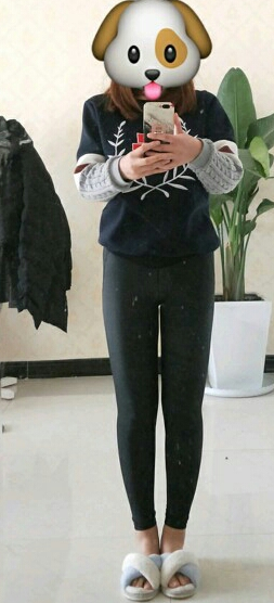 吸脂后结合饮食瘦了20斤下来,身材重回20岁的样