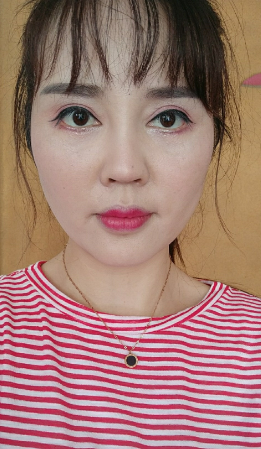 面部*提升70多天了，来这里反馈一下*果
