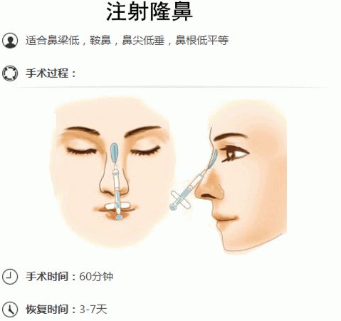 长沙华美隆鼻好不好?有哪些隆鼻方法?