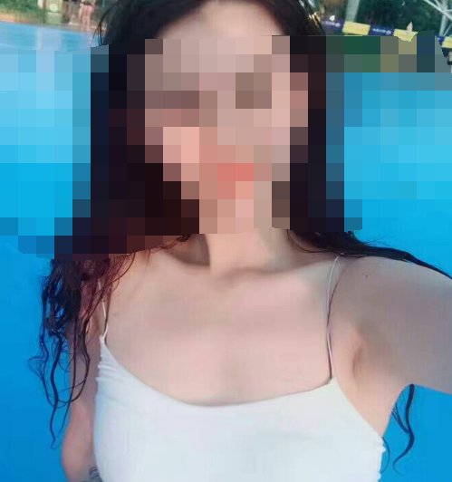 成都哪家医院做自体脂肪隆胸好?有案例吗?