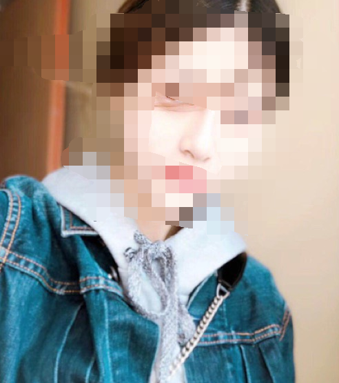 北京雅靓医院做自体耳软骨隆鼻要多少钱?