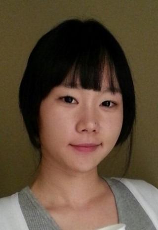 全切双眼皮+开内眼角+开外眼角记录，分享一波