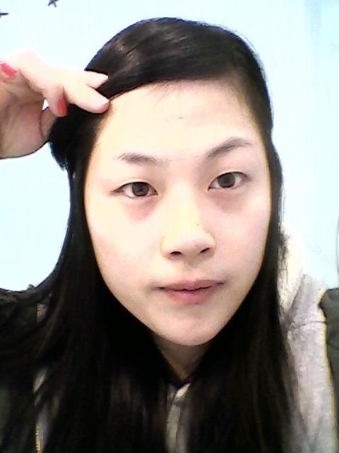 *+*,矫正鹰钩鼻