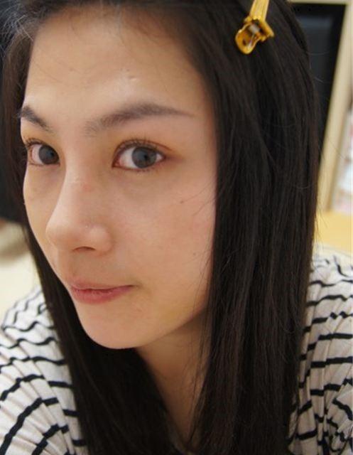 *+*,矫正鹰钩鼻