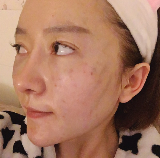 *只能做一次吗?