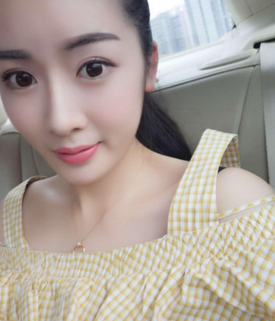 成都天使之翼整形医院隆鼻怎么样?做*多