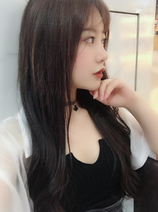 武汉硅胶隆鼻，恢复300天了，挺美的