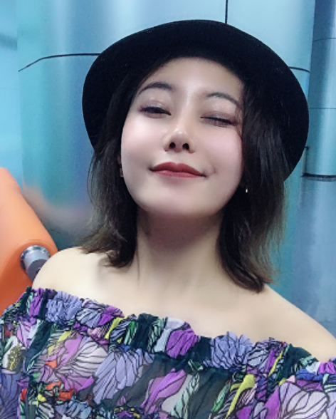 武汉硅胶隆鼻，恢复300天了，挺美的