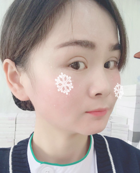 上海磨骨第75天了，已经消肿，*果不错