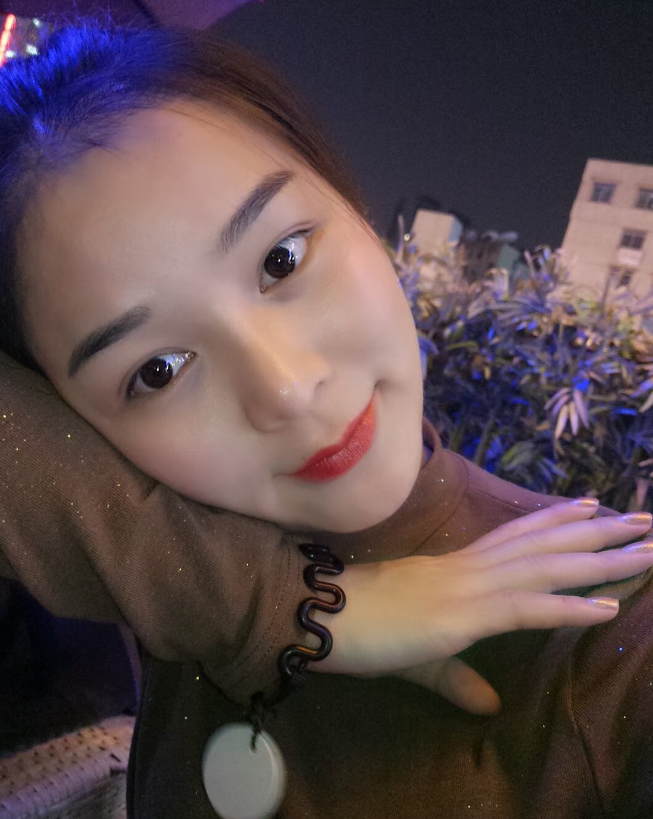 长沙磨骨200天了，王勇医生做的，恢复的好快