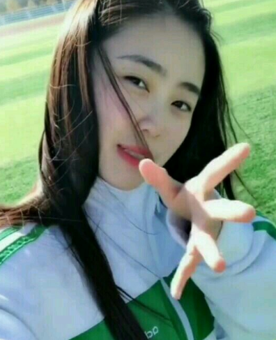 北京南加自体脂肪填充面部术后第97天