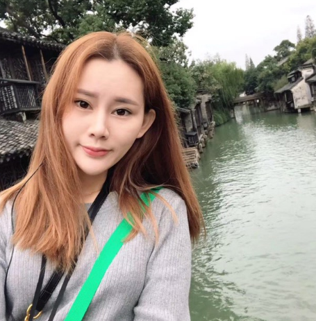北京叶美人自体脂肪填充面部的*果怎么样？案