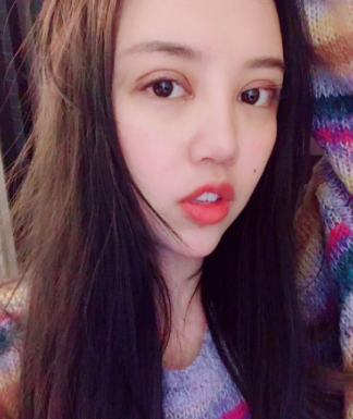 重庆做双眼皮哪家医院好？案例？