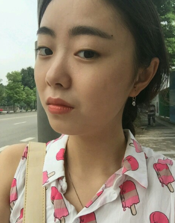 成都美极做双眼皮好不好？有案例吗？