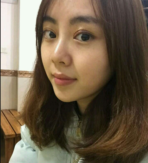 成都美极做双眼皮好不好？有案例吗？