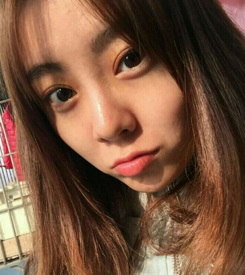 成都美极做双眼皮好不好？有案例吗？